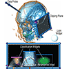 Multi-dimensional transfer functions in J. Kniss, G. Kindlmann, and C. Hansen 2002: Multi-dimensional transfer functions for interactive volume rendering