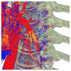 Multi-volume rendering using BSP in S. Lindholm, P. Ljung, M. Hadwiger, and A. Ynnerman 2009: Fused multi-volume DVR using binary space partitioning