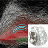 Multi-level focus+context in P. Muigg, J. Kehrer, S. Oeltze, H. Piringer, H. Doleisch, B. Preim, and H. Hauser 2008: A four-level focus+context approach to interactive visual analysis of temporal features in large scientific data