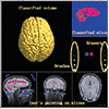 Machine learning in F.-Y. Tzeng, E. Lum, and K.-L. Ma 2005: An intelligent system approach to higher-dimensional classification of volume data